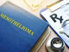 5 Key Questions to Ask a Mesothelioma Lawyer Before Hiring Them Mesothelioma Lawyer